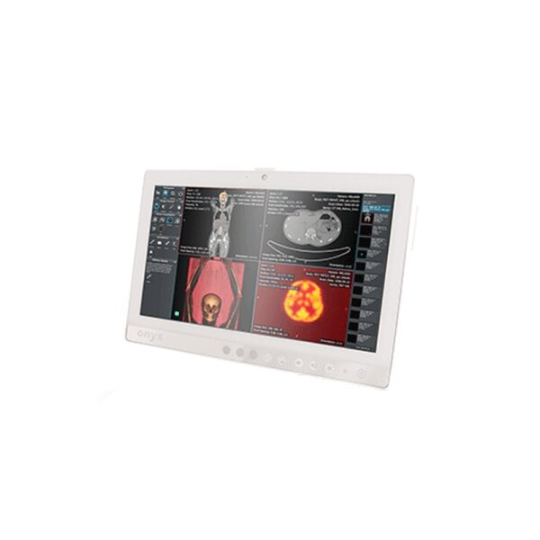 Onyx Patient Monitor